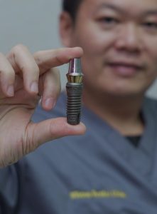dental implant