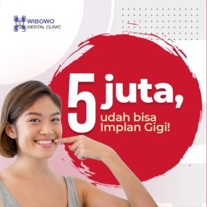 harga implan gigi