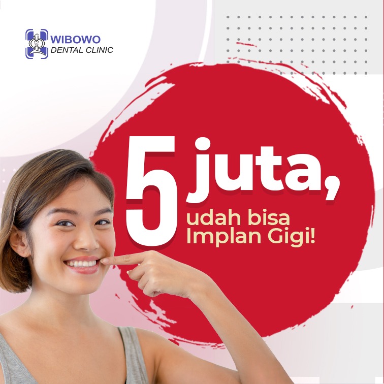 harga implan gigi