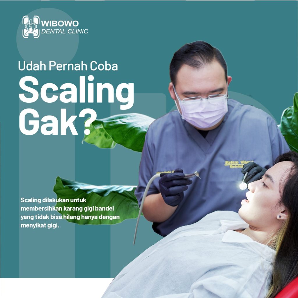 scaling gigi
