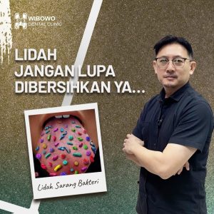 Cara Membersihkan Lidah