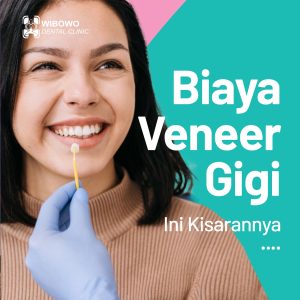 biaya veneer gigi