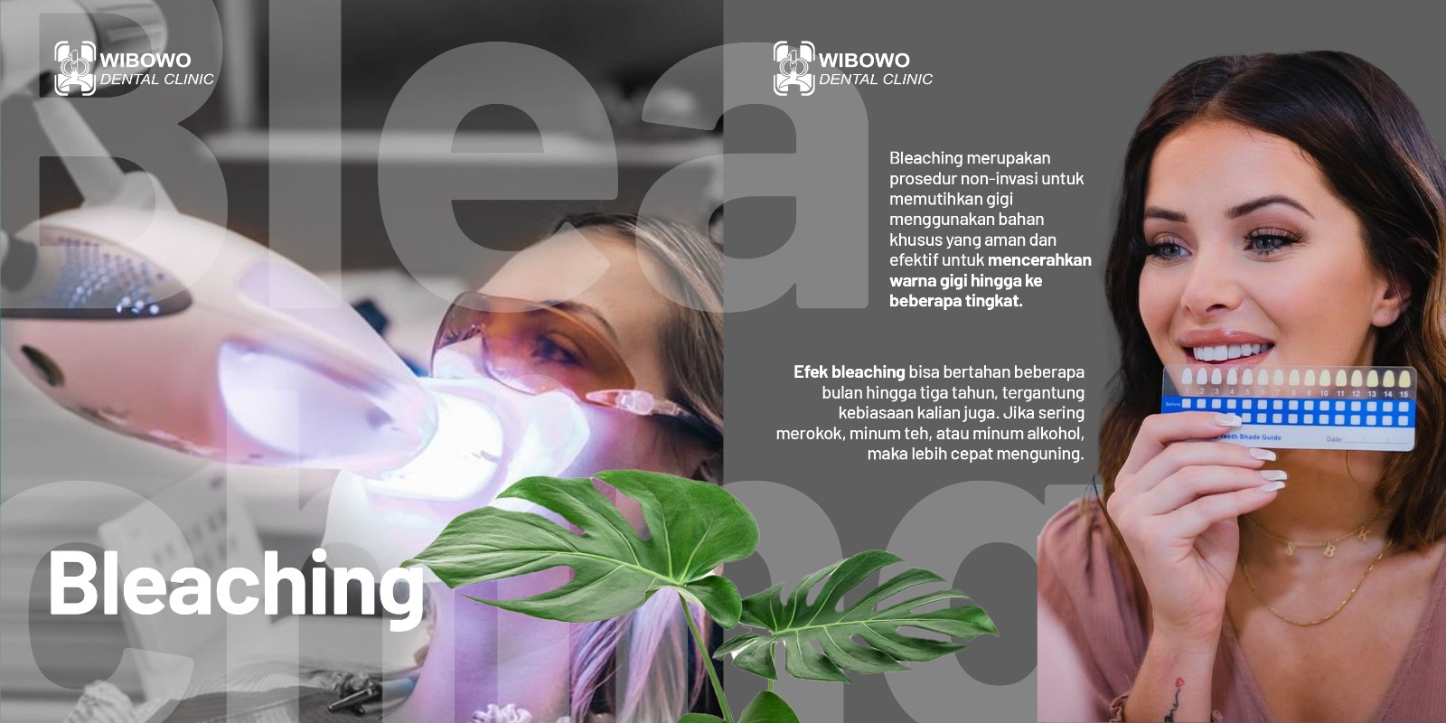 harga bleaching gigi