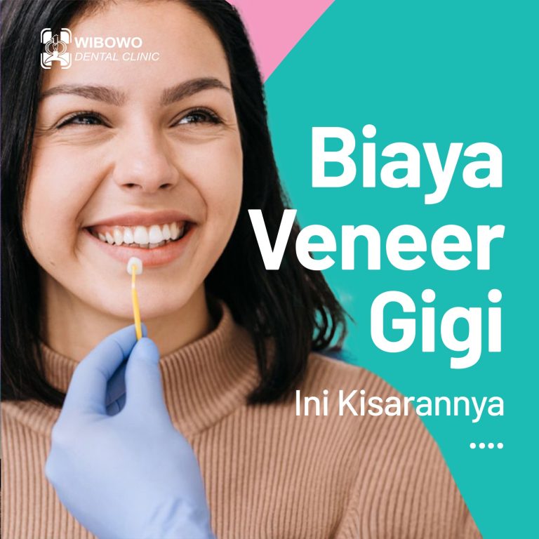 biaya veneer gigi