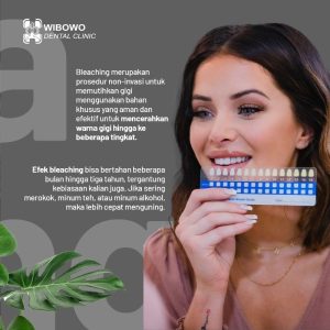 bleaching gigi