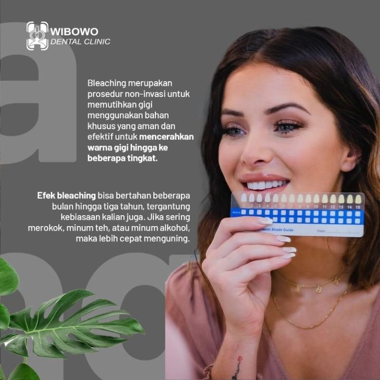 bleaching gigi