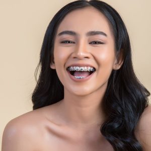 pasang behel gigi