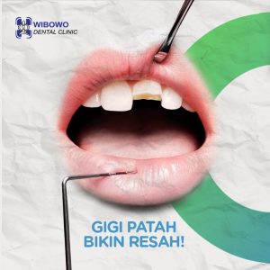 gigi patah