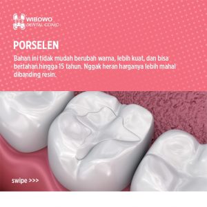 Tambalan gigi porselen