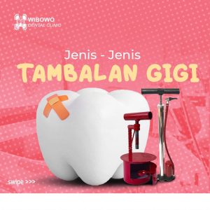 Jenis tambalan gigi