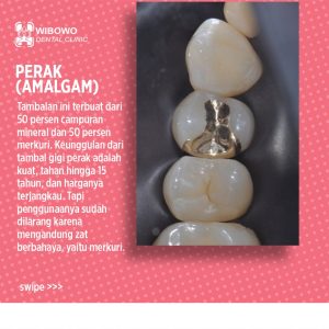 Tambalan Gigi Perak 
