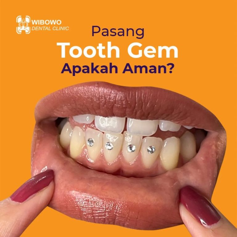 pasang tooth gems