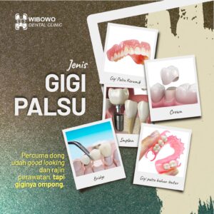 harga pasang gigi palsu