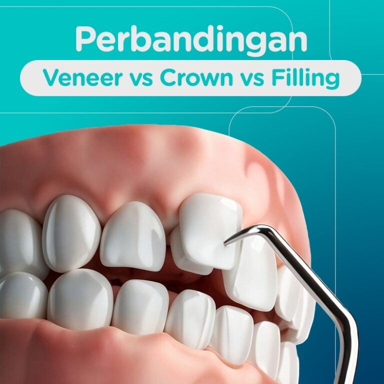 Veneer Crown Filling