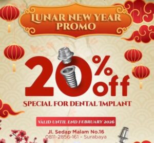 Diskon Implan Gigi