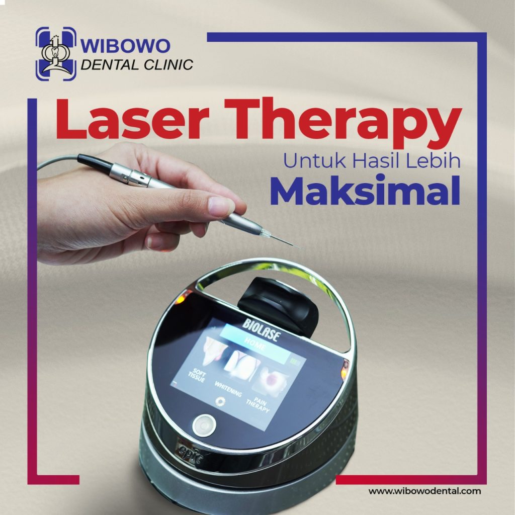 laser gigi
