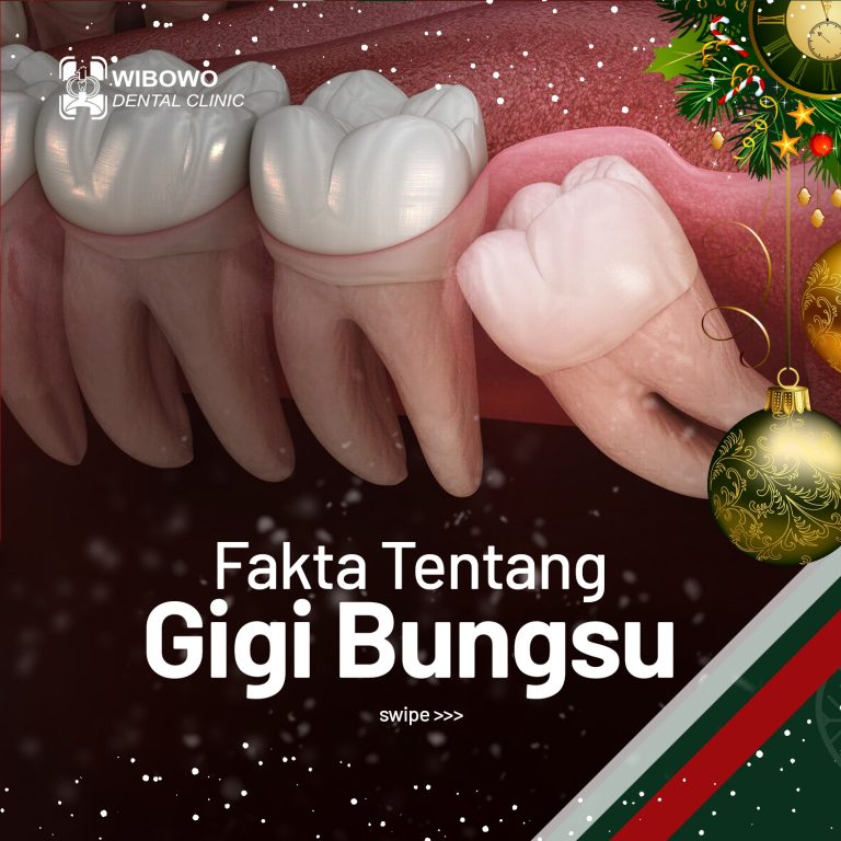 operasi gigi geraham