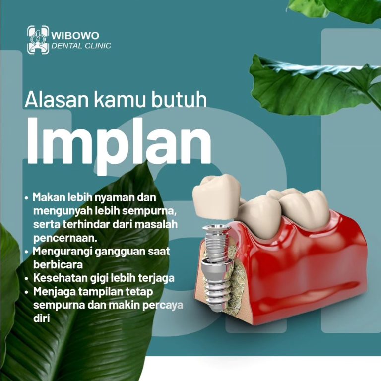 Tanam Gigi Surabaya, Pastikan Pilih yang Terpercaya