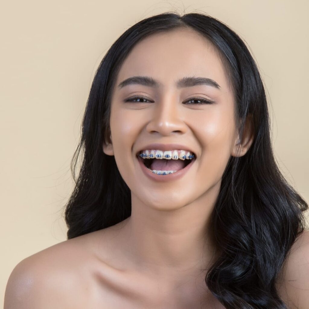 kawat gigi