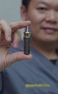 dental implant